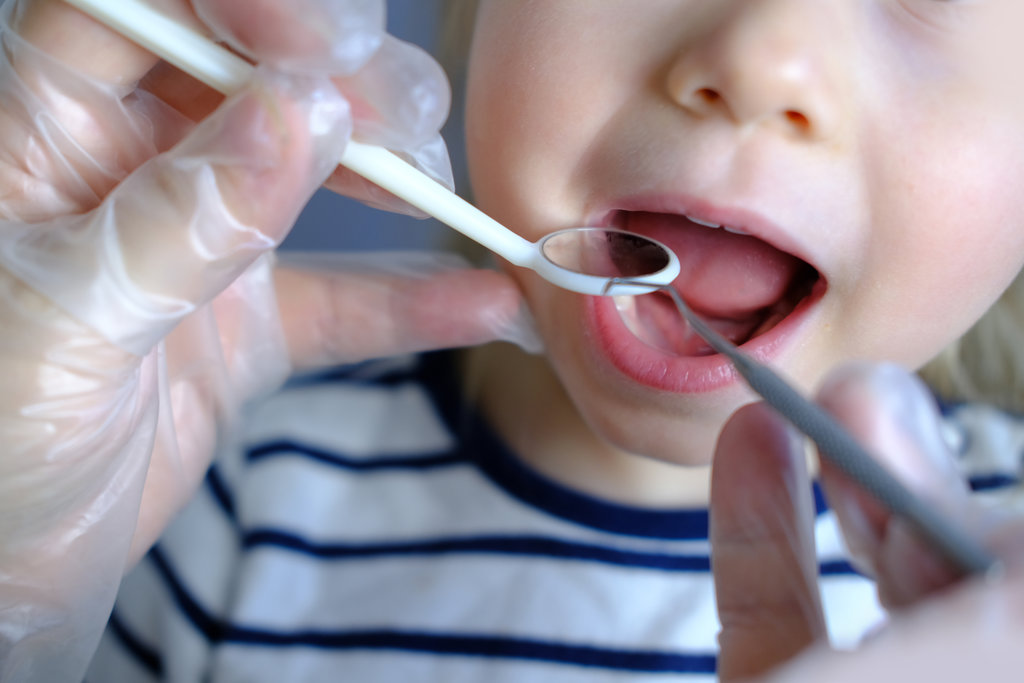 dentist, doctor examines oral cavity of small patient, uses mouth mirror, closeup baby teeth child, concept pediatric dentistry, dental treatment, correction of occlusion, oral care, caries prevention