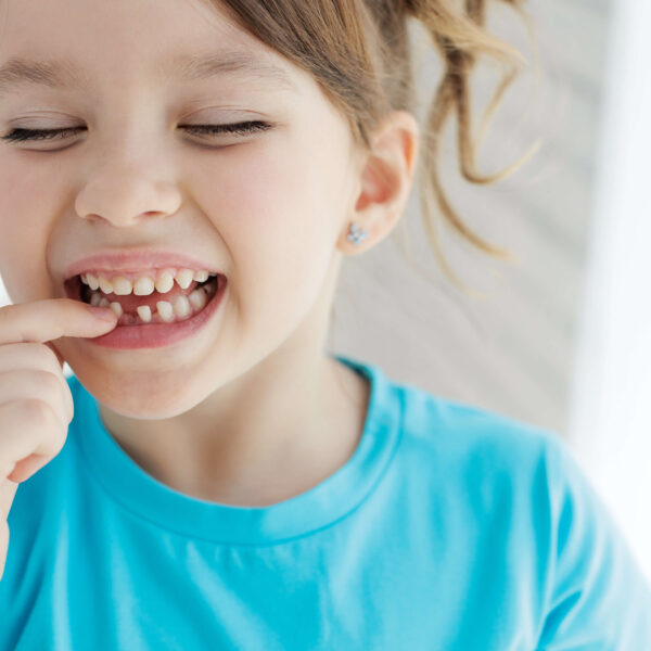 Loose AdobeStock 530005777 1 - All Kids Pediatric Dentistry