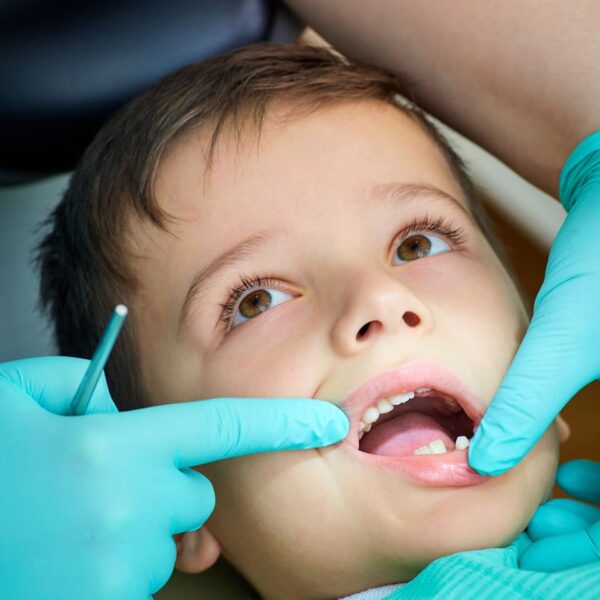 3 3 - All Kids Pediatric Dentistry