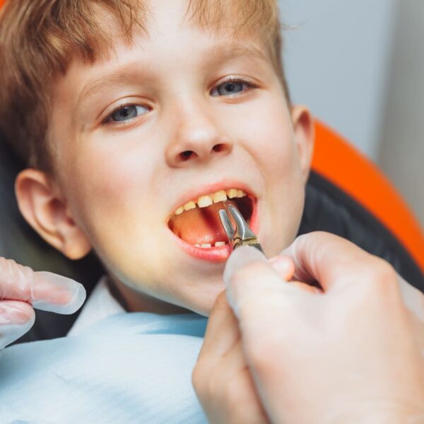 5 2 - All Kids Pediatric Dentistry