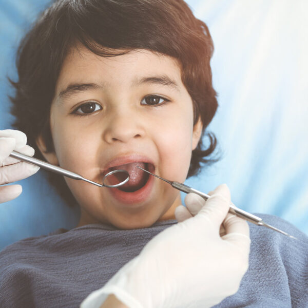 Cute arab boy sitting at dental chair with open mouth during oral checking up with doctor. Visiting sunny dentist office.
