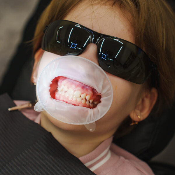 Professional dental hygiene for children in a dental clinic setting