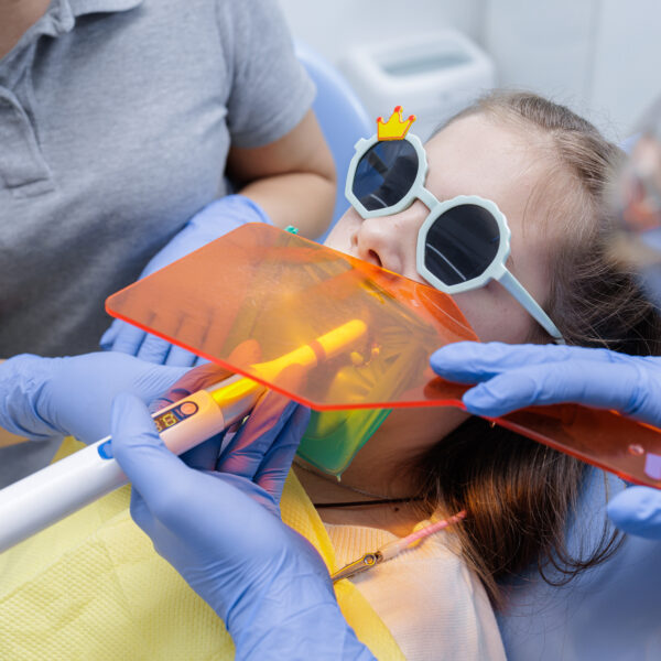 Dentist cures composite under orange shield with rubber dam while a child wears fun glasses, highlighting safe pediatric restoration and isolation in clinic.