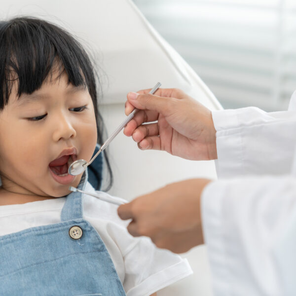 Dentist or dentist treating or examining a little girl teeth, Child receiving treatment from dentist, medicine, dentistry and healthcare, annual checkup, fluoride coating, tooth decayฃ