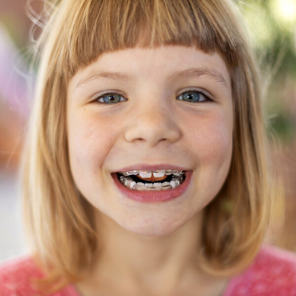 Portrait of smiling little girl with braces