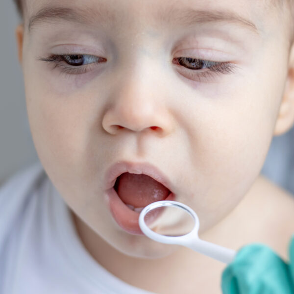 baby boy kid infant toddler at dentist doctor.hand in surgical glove checking first milk teeth with mouth mirror healthy tooth no caries tartar.wide banner mockup space for text dental care daily