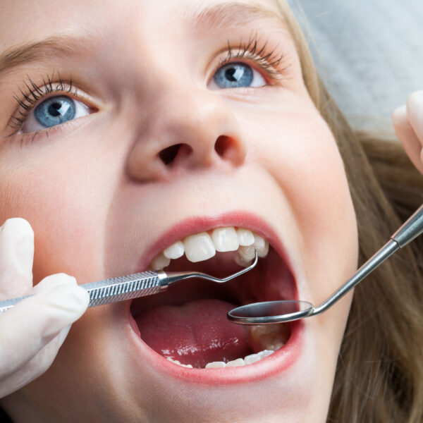 Macro close up portrait of Little girl with open mouth having dental check up.