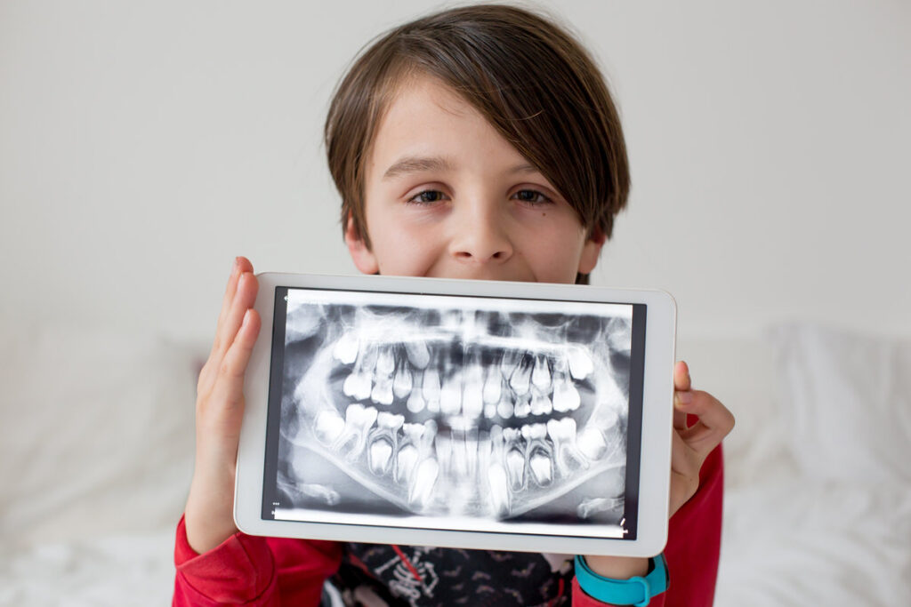 Child, preteen boy, holding tablet with a picture of his x-ray teeth from the dentist