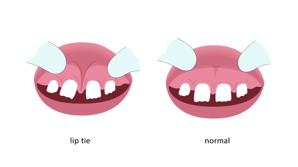 AdobeStock 555081937 - All Kids Pediatric Dentistry