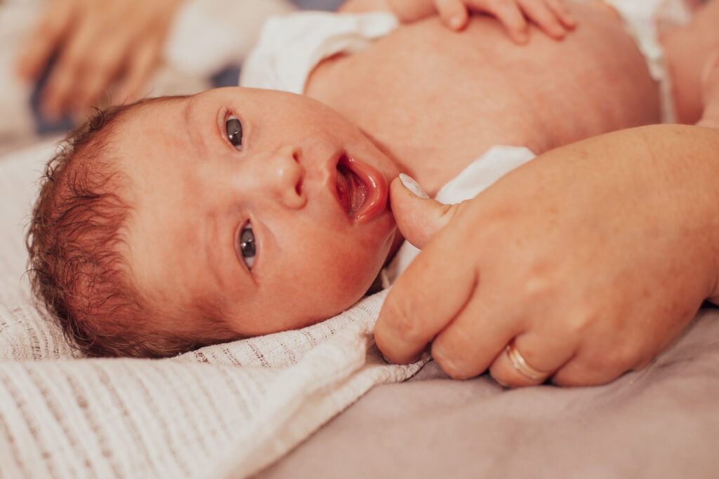 The examination of newborn baby mouth, short frenulum of the tongue